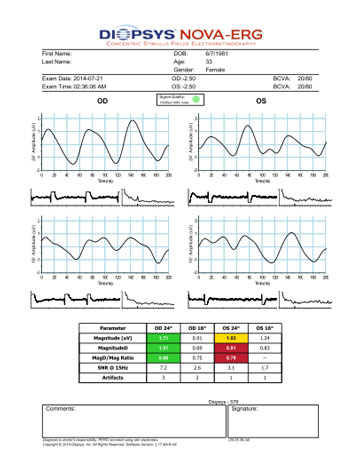 Nova ERG Report