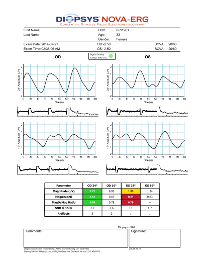 nova-erg-report